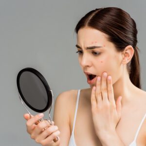 Acne treatment