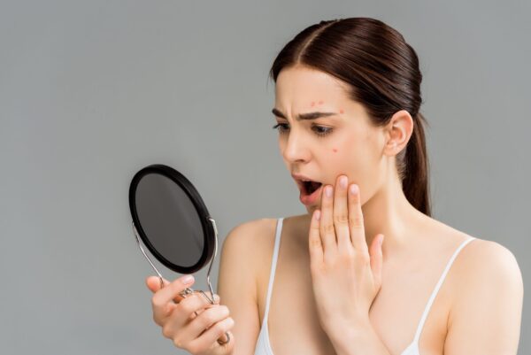 acne Acne treatment