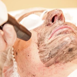 Carbon Laser Treatments