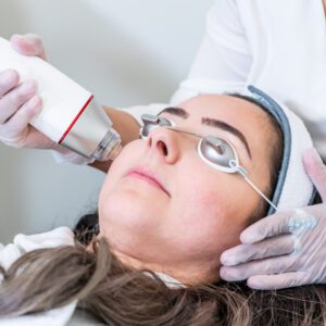 Skin Tightening Treatment